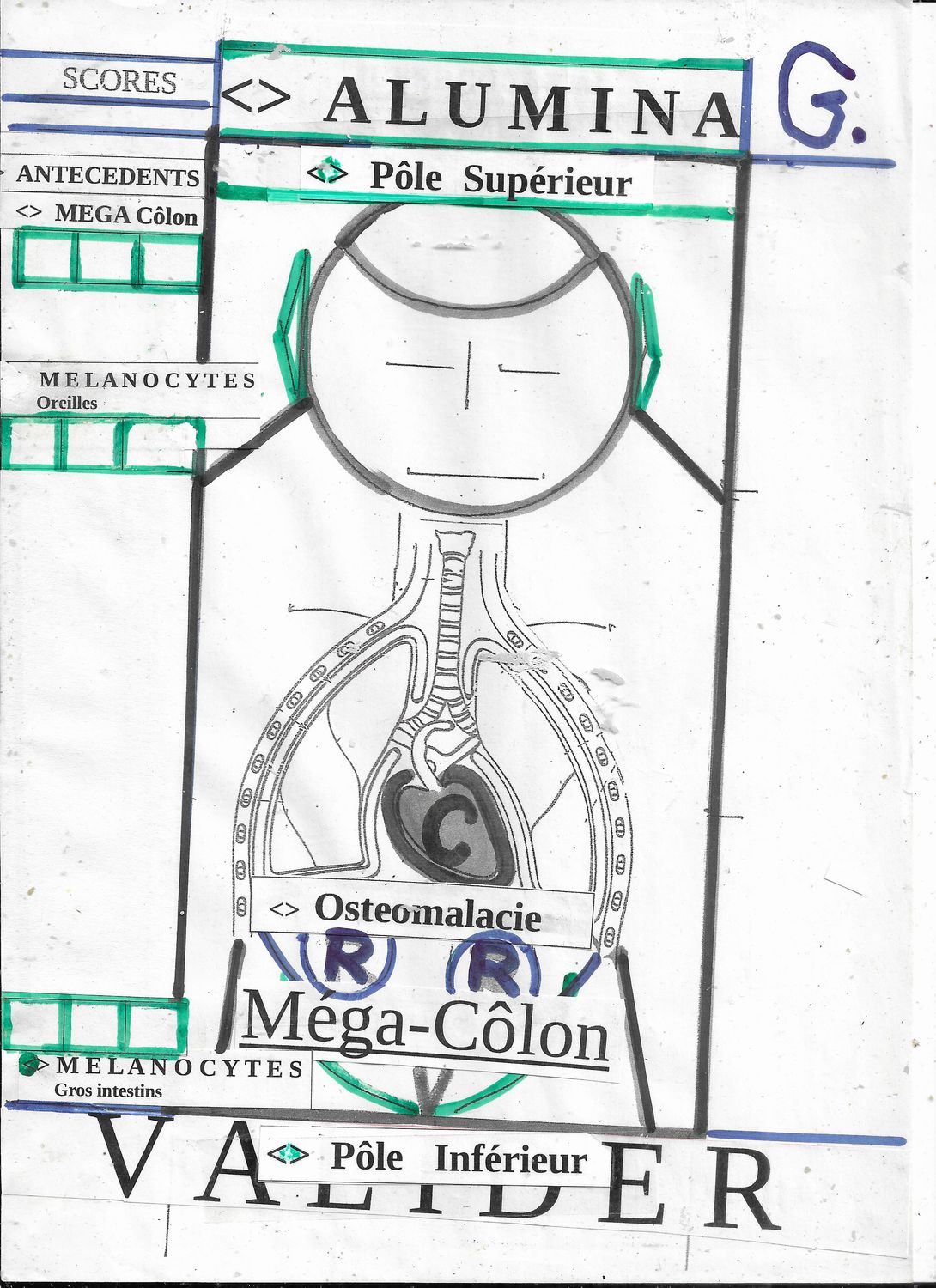 Alumina - Méga côlon