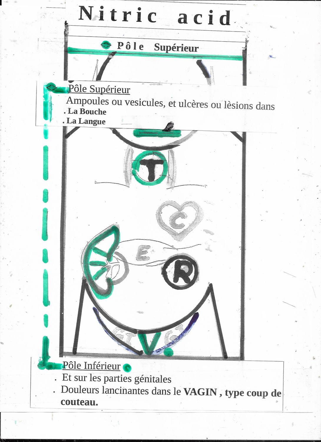 Nitric acid | Pôle supérieur | Pôle Infer.