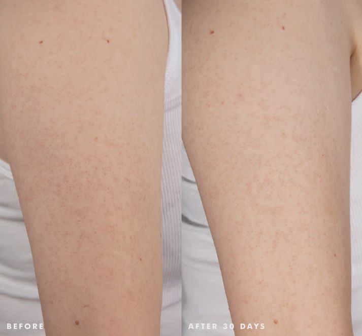 Smooth Reveal Resurfacing Silky Serum