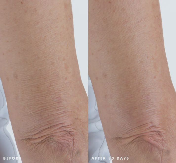 Smooth Reveal Resurfacing Silky Serum