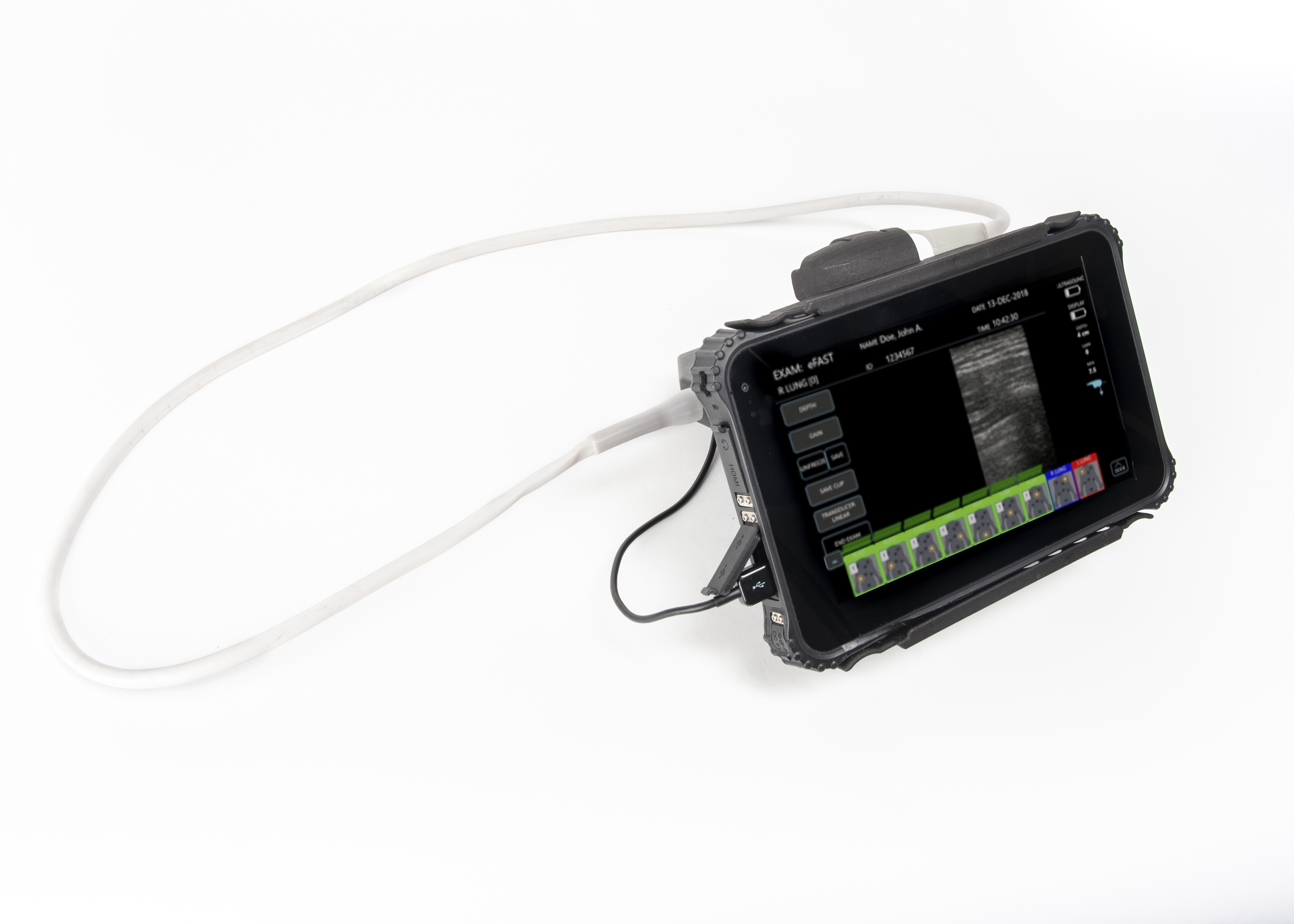 Sonivate SonicEye Dual-Array Ultrasound System