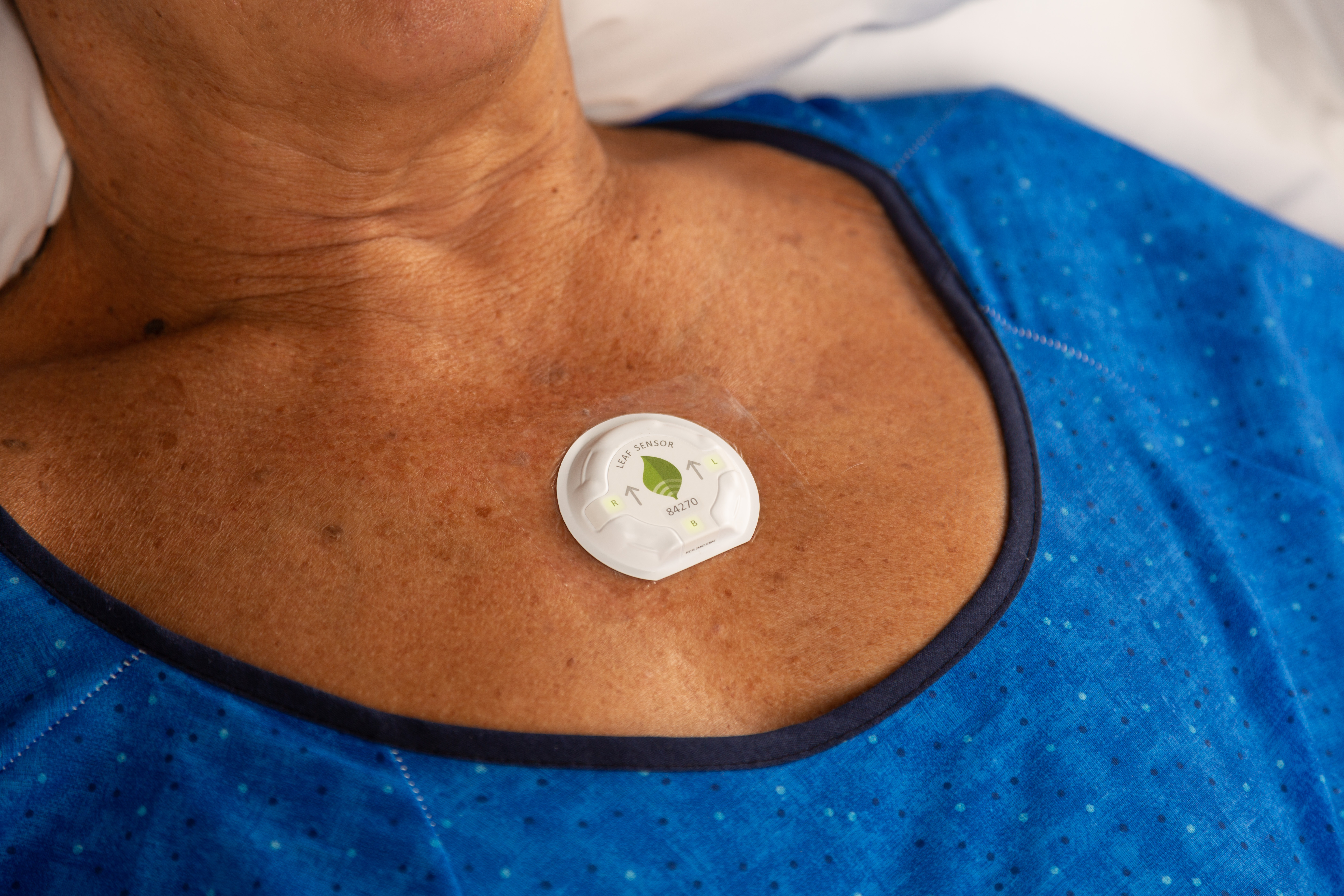 Leaf Patient Monitoring System