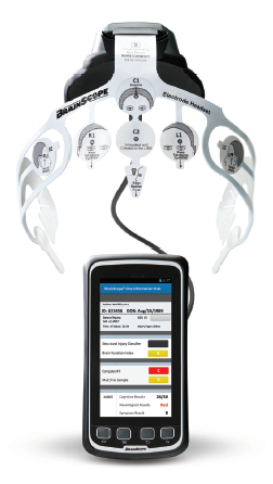 BrainScope Device (500 Series with Concussion Index, MACE2 and 1 year warranty) BSO-2001