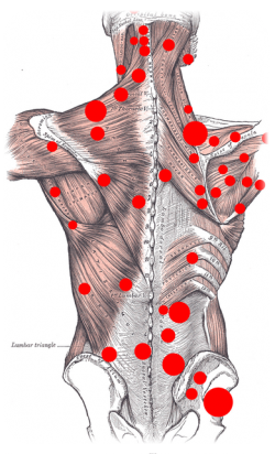 Triggerpunkttherapie  20 min.