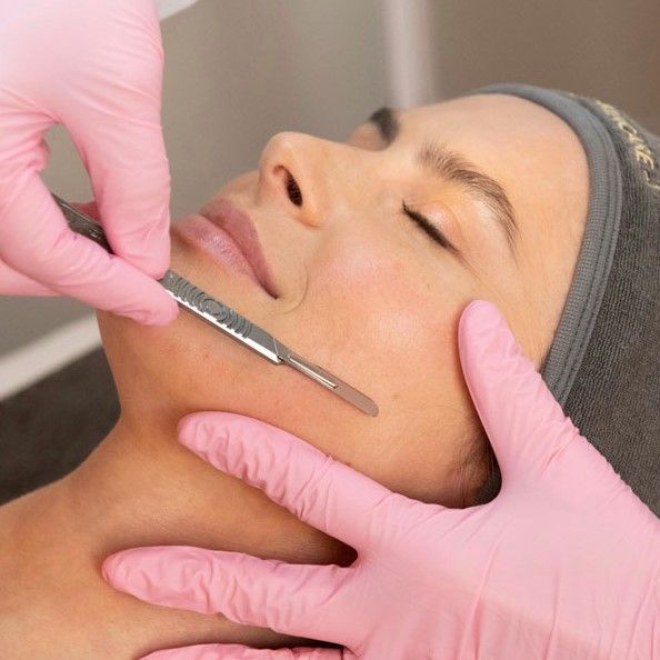 Dermaplaning