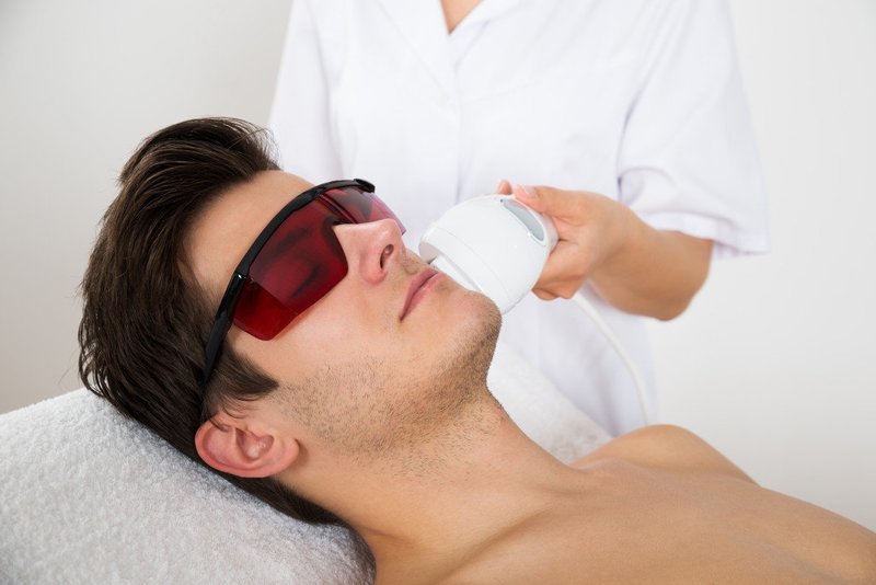 Mens Laser Hair Removal - 6 Treatments