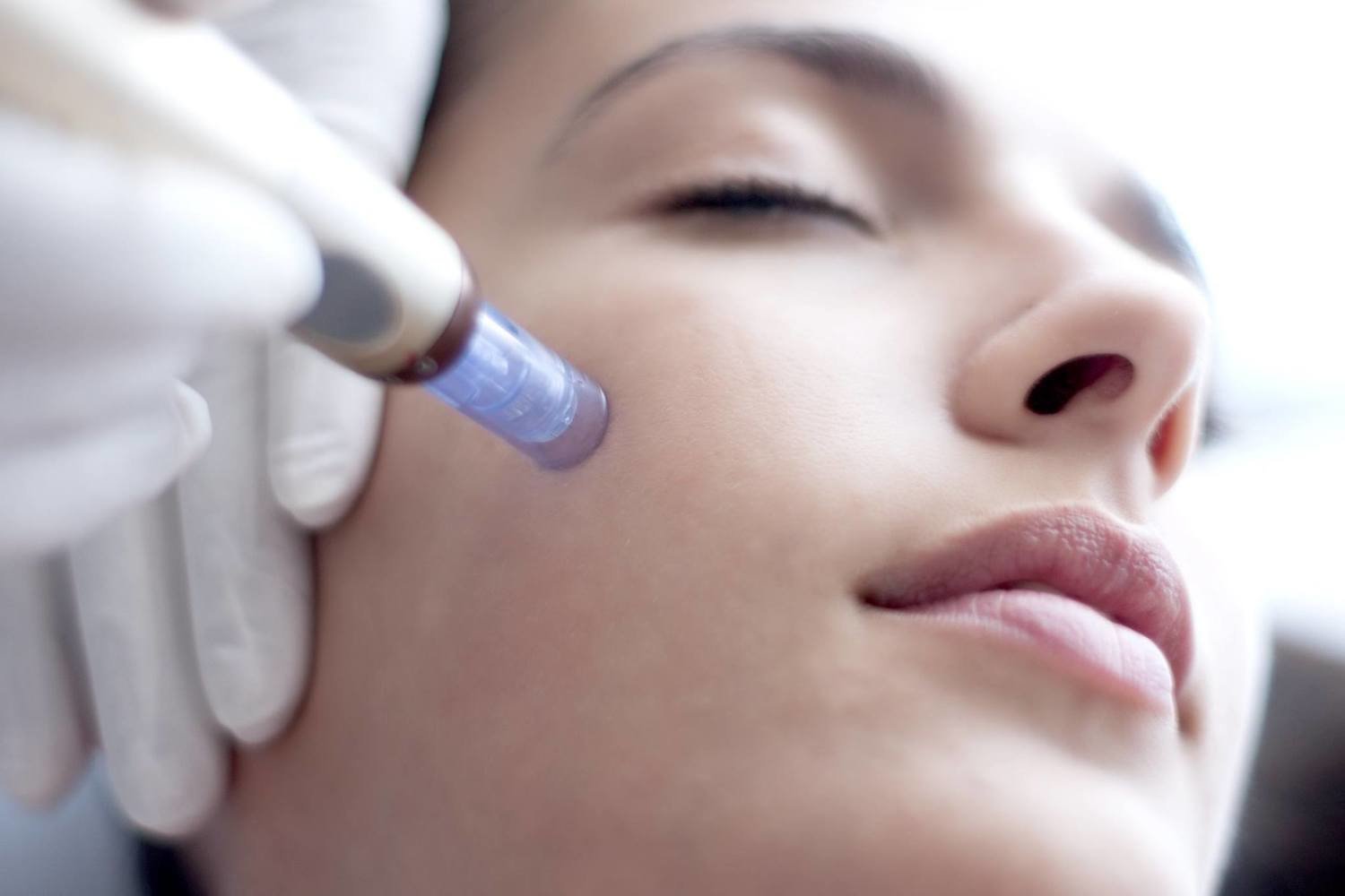 Microneedling &amp; Express HydraFacial MD