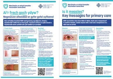 ​Ai’r frech goch ydyw?  Is it measles? A3 poster  **Please note: this resource will be sent to you in separate E+W versions and are to be displayed simultaneously within clinical settings**