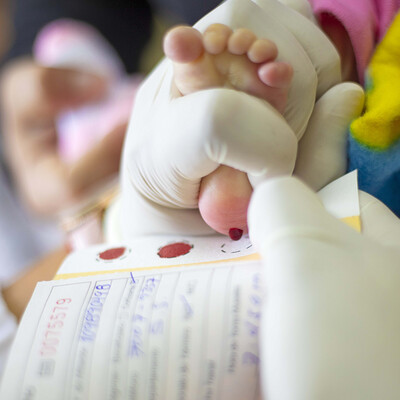 Tamiz neonatal