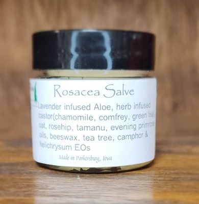 Rosacea Cream