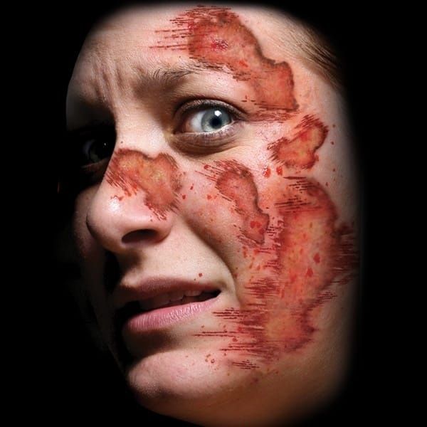 TRAUMA TAT ROAD RASH