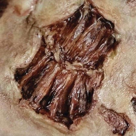 FX TRANSFERS ZOMBIE BITE