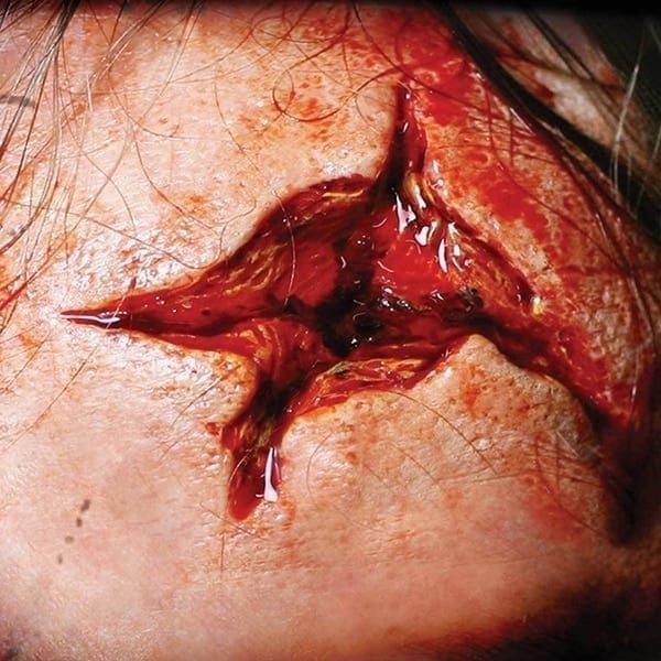 FX TRANSFERS POINT BLANK