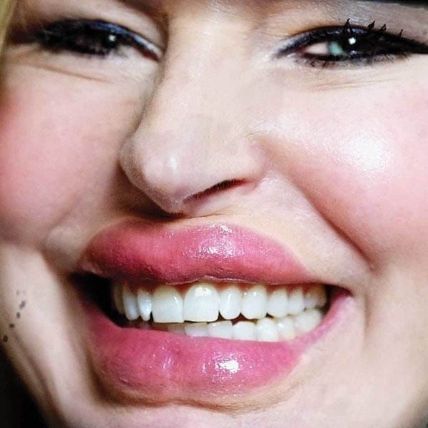 FX TRANSFERS LIP/TUCK