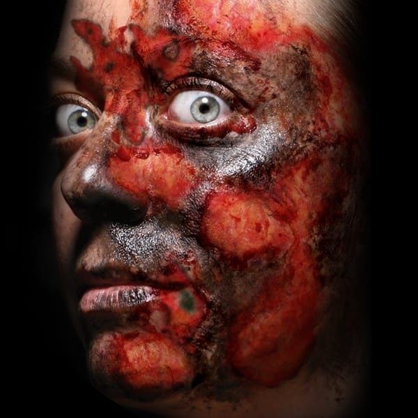 TRAUMA TAT BURNED ALIVE