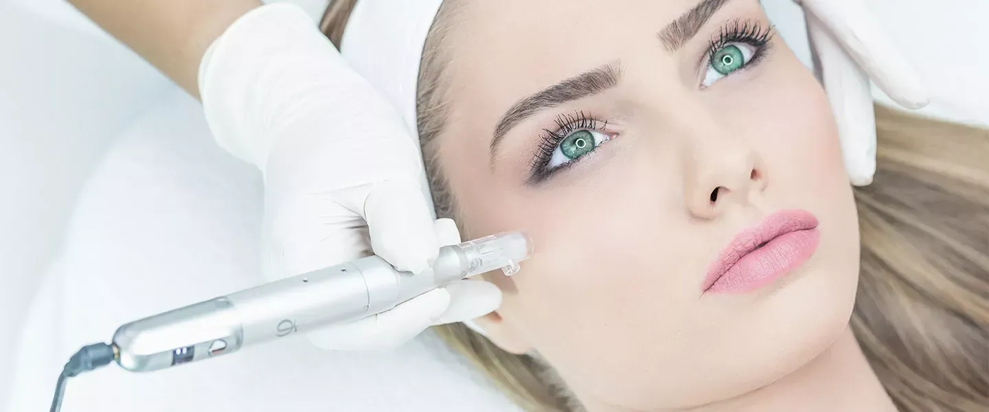 Rejuvence tu piel con microneedling + Ácido hialurónico