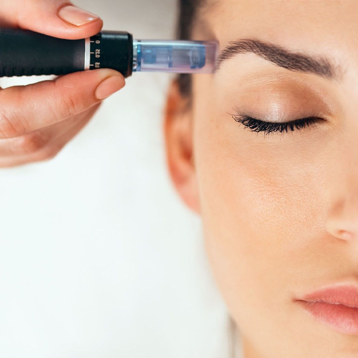 3 CONTORNO OJOS CON MICRONEEDLING Y MESOTERAPIA