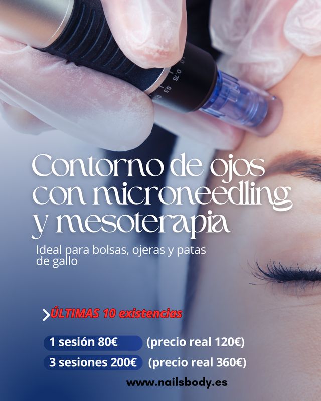 TRATAMIENTO CONTORNO OJOS CON MICRONEEDLING Y MESOTERAPIA