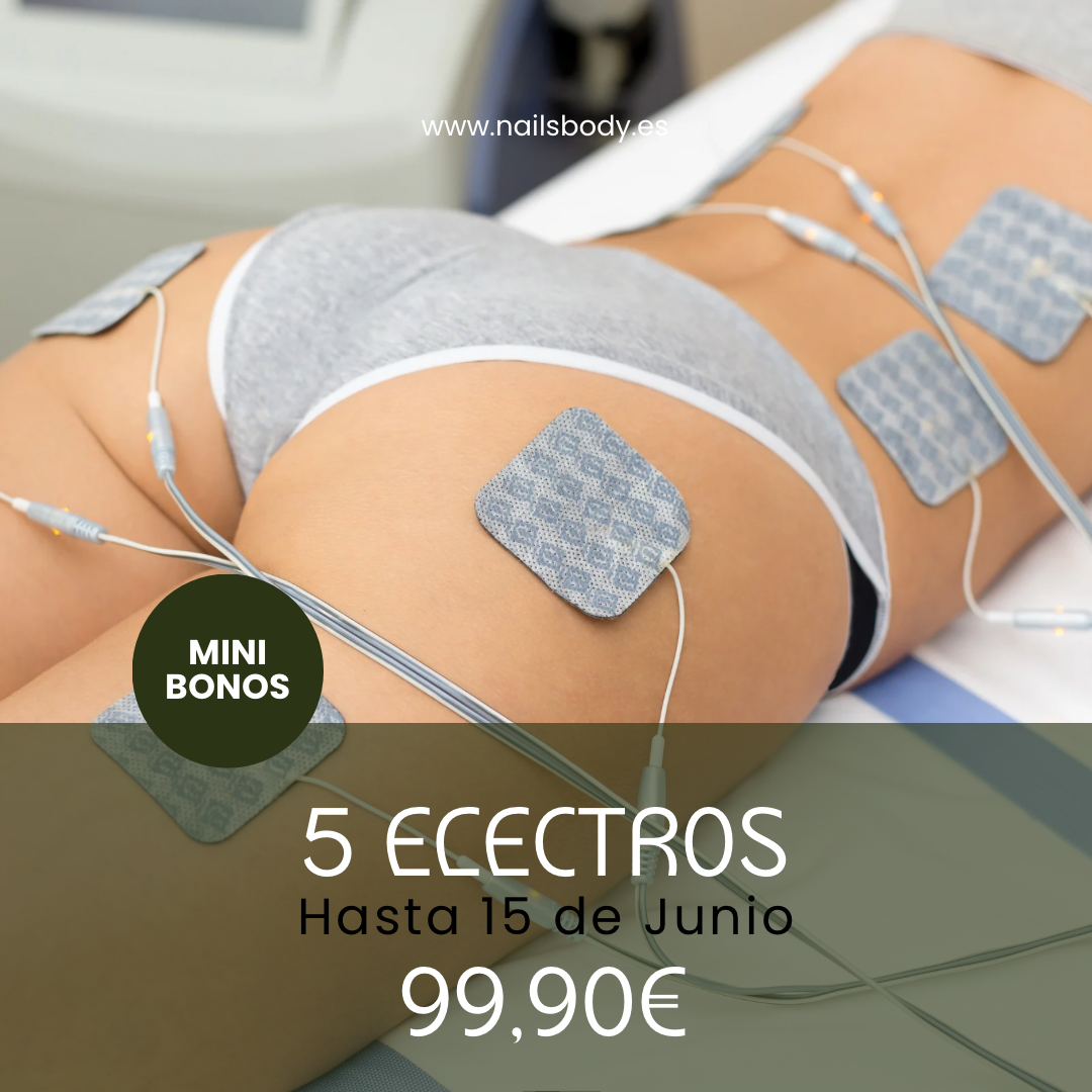 5 ELECTROS MINIBONOS