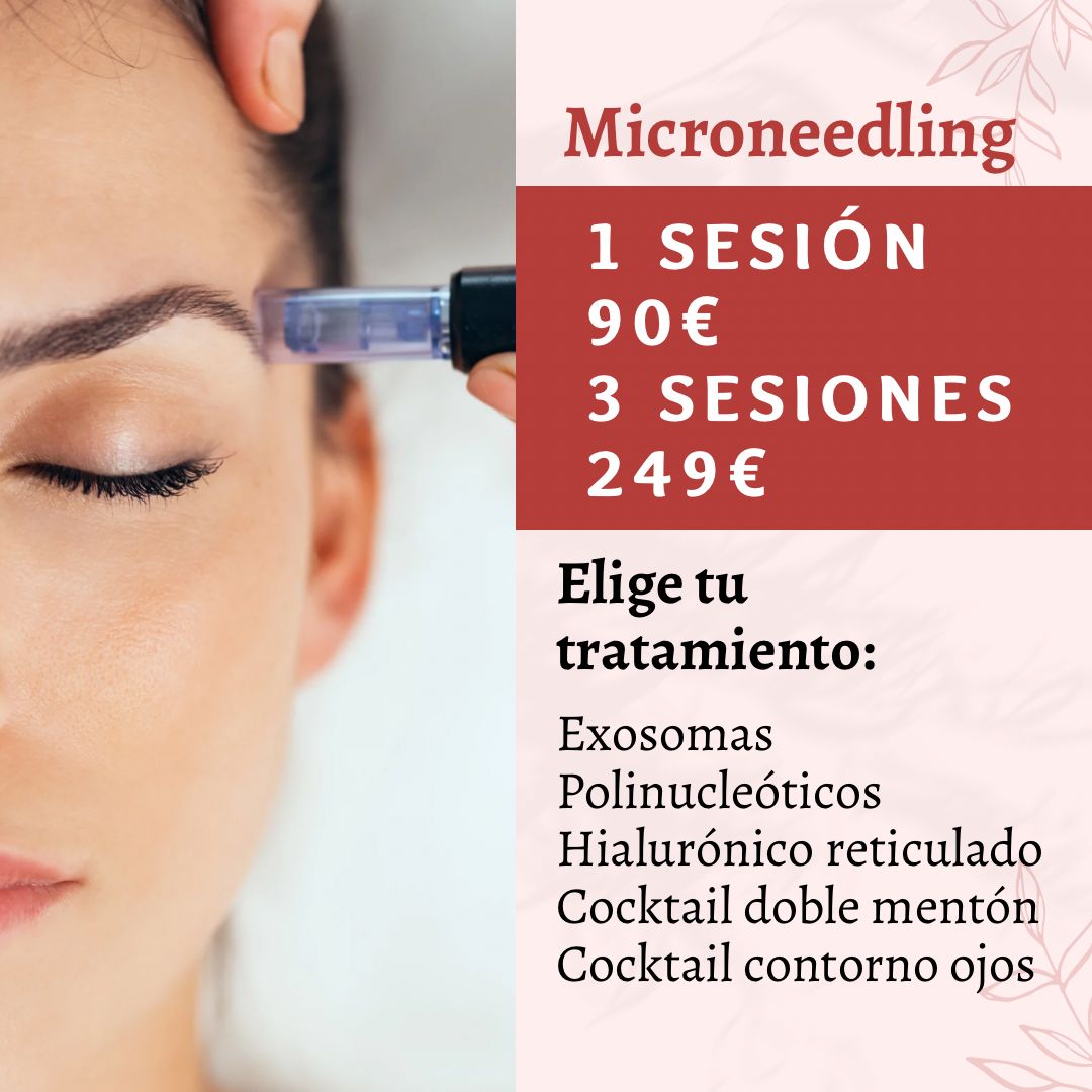 Microneedling 3 sesiones FULL FACE