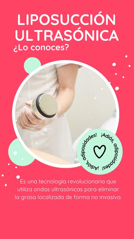 10 Liposucciones ultrasónicas