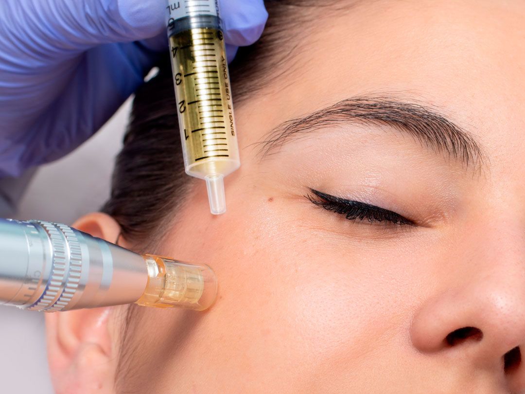 EXOSOMAS faciales 3 SESIONES Día de la Madre