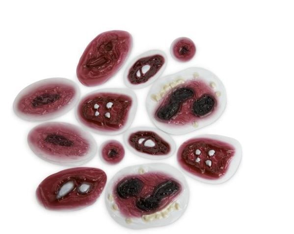 Kit de plaies saignantes 3B SCIENTIFIC