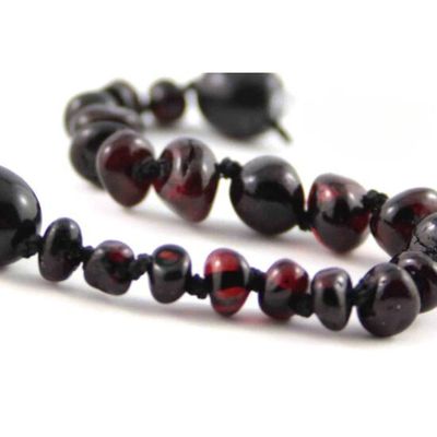 Healing Amber Necklace Molasses