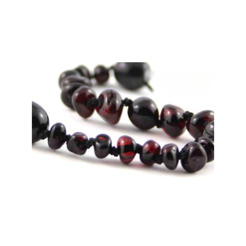 Healing Amber Necklace Molasses