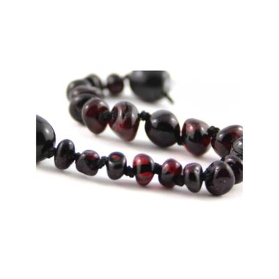 Healing Amber Necklace Molasses