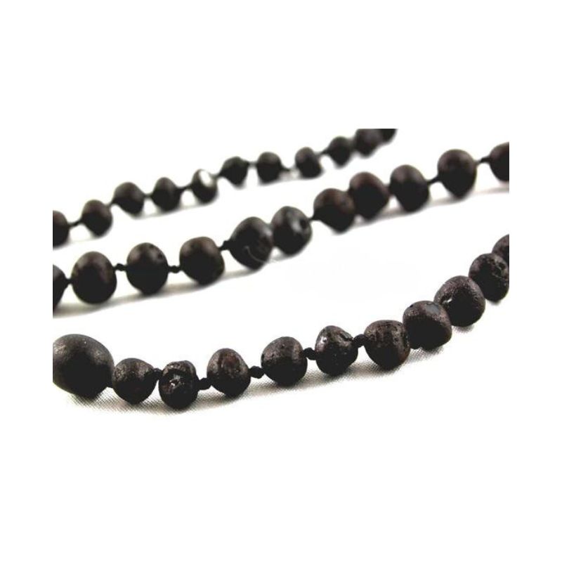 Healing Amber Necklace Raw Molasses