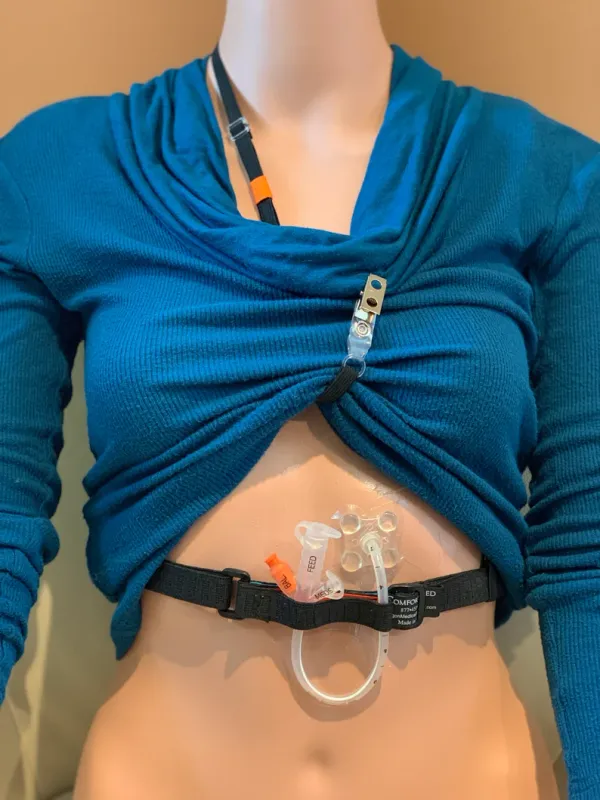 Maritz Feeding Tube Set