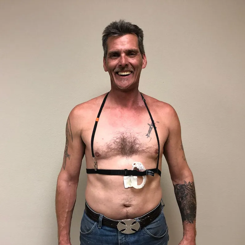 Maritz Feeding Tube Belt (x2) Set