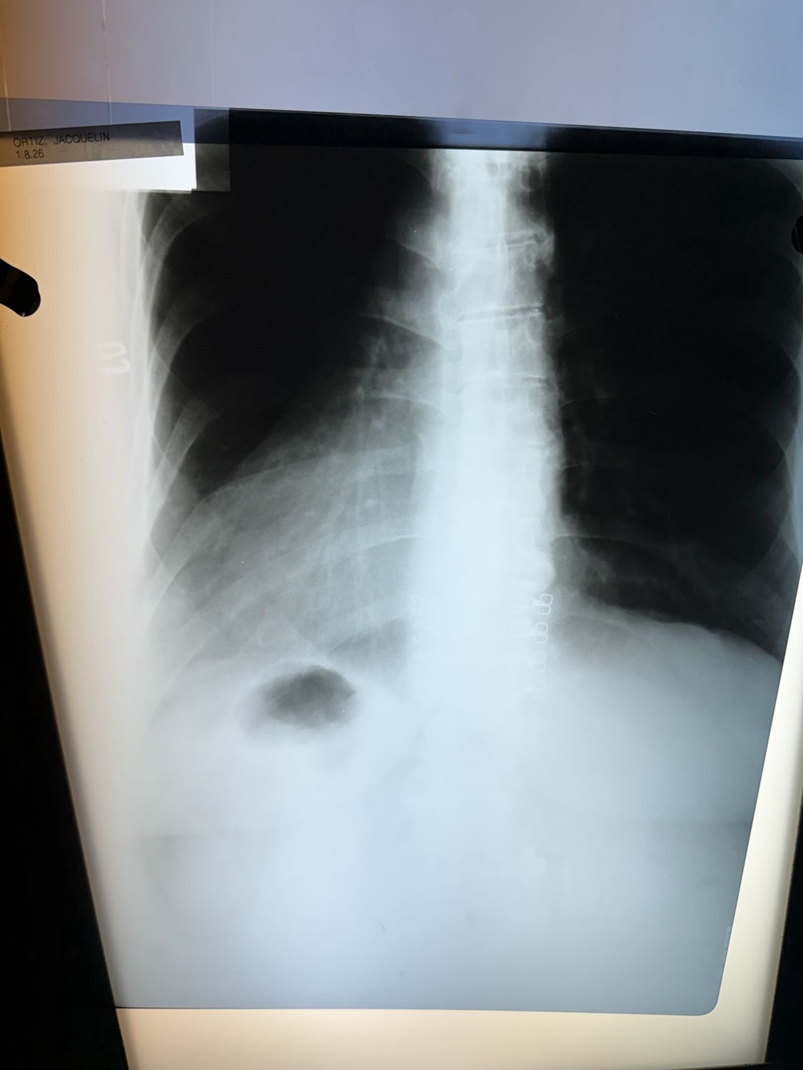 xray full spine
