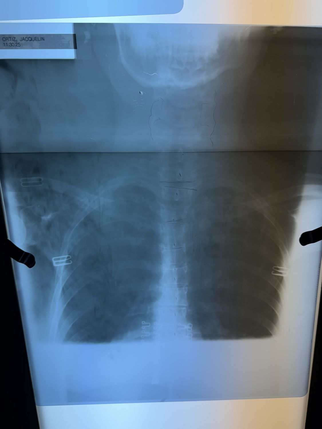xray full spine