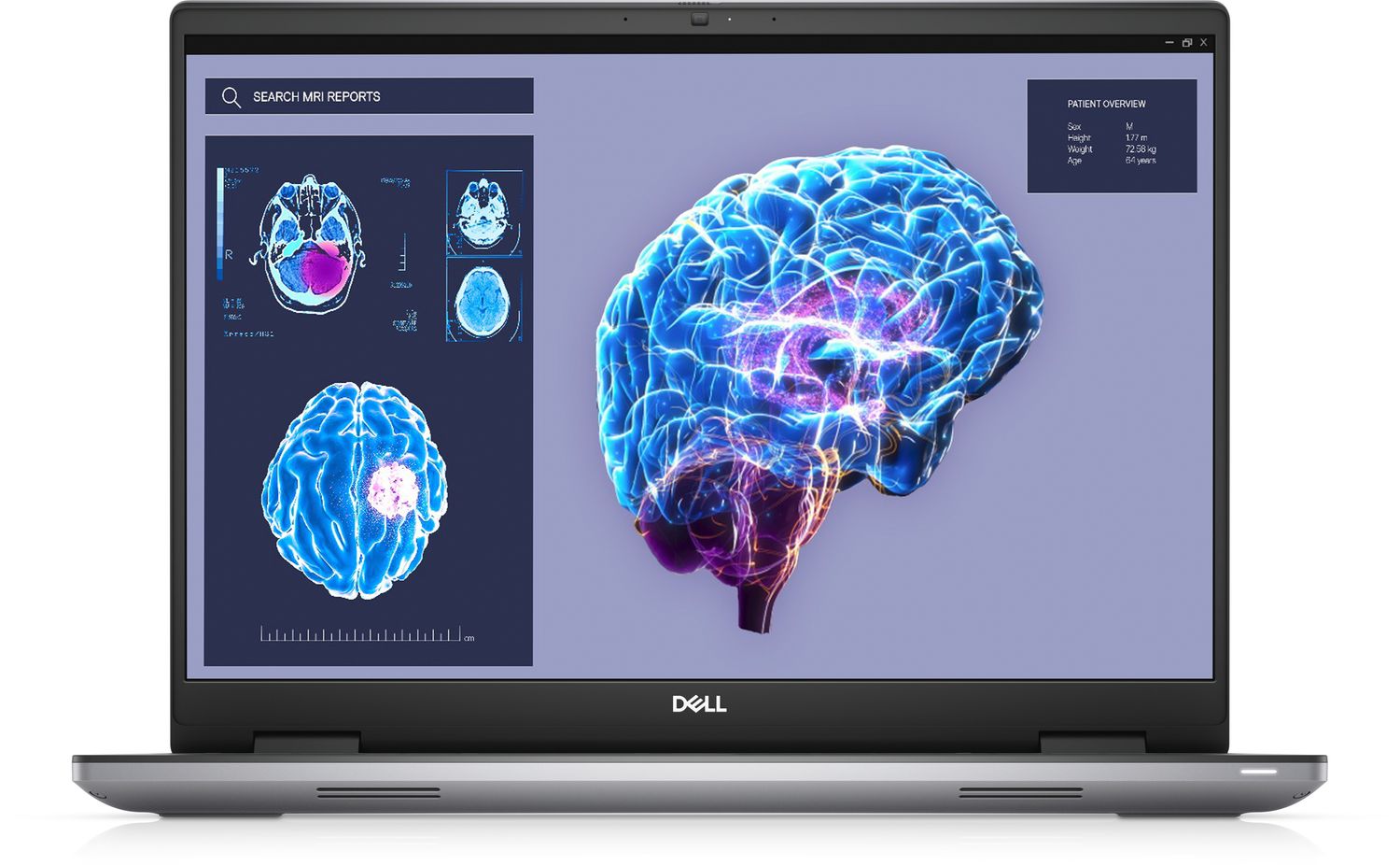 DELL Precision 7680 Intel® Core™ i7 i7-13850HX Mobiel werkstation 40,6 cm (16") Full HD+ 32 GB DDR5-SDRAM 1 TB SSD NVIDIA RTX 2000 Ada Wi-Fi 6E (802.11ax) Windows 11 Pro Grijs