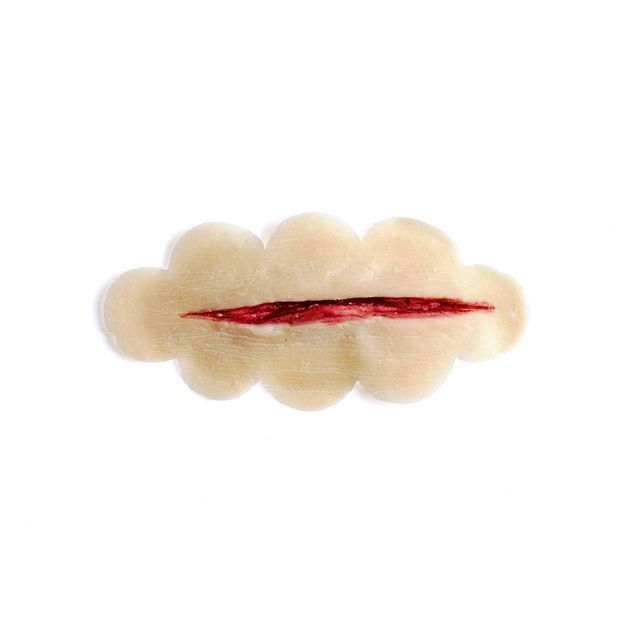2” Laceration