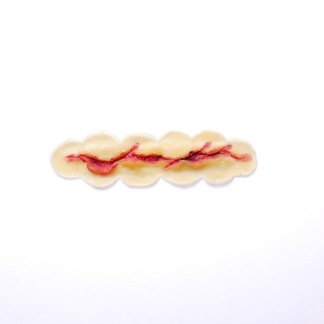 4” Laceration