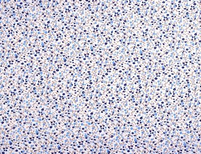 Blue Flowers On White