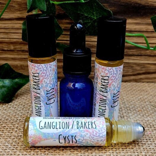 Ganglion/Bakers Cysts Natural Relief