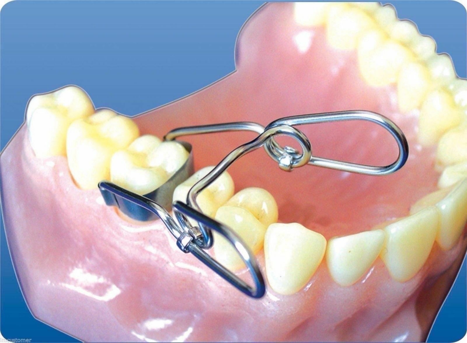 матричные системы в стоматологии. набор матриц garrison. палодент матричная система. кольца стоматологические для матриц. Wago trix матричные кольца.