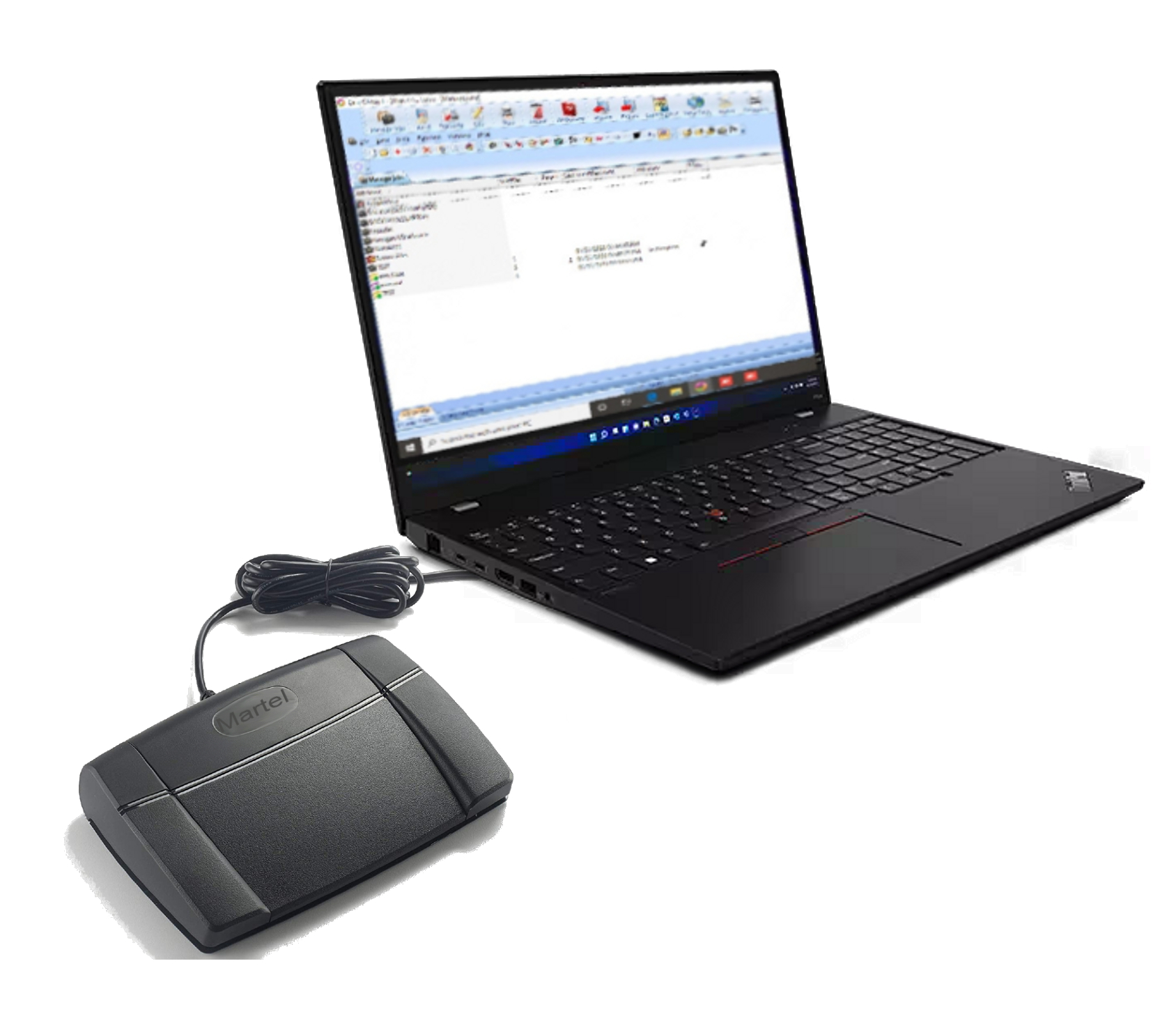 Case CATalyst Foot Pedal