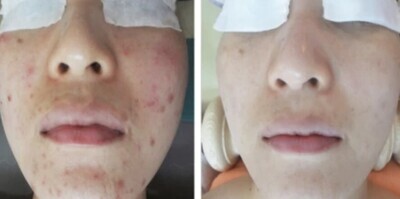 DA-1 GROWTH FACTOR CICATRIX Skin Ampoule Serum