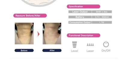 RAYSURE LASER SHAPING DEVICE