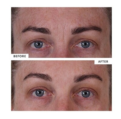 SILCSKIN Anti-Wrinkle Patches