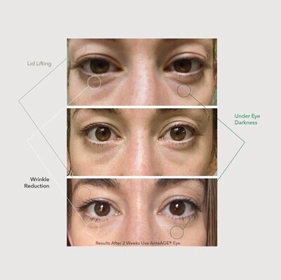 AnteAGE® Eye Cream