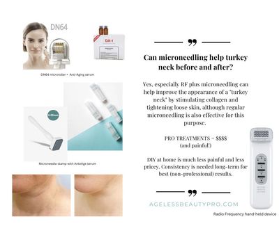 TURKEY NECK ANTI-AGING (DIY vs. OFFICE)