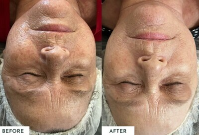SKIN ENHANCER DEVICE - Tone, Cleanse, Contour, LED