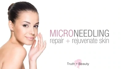 Microneedling Skin Rejuvenation & Skin Tightening Package