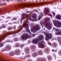 Myeloma Plasma